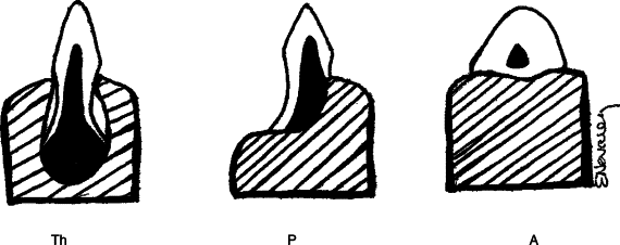 Image result for varanid pleurodont method