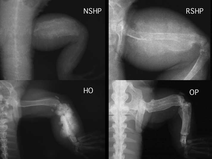 Metabolic Bone Diseases