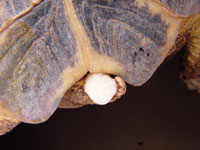 Bladder Stone 200