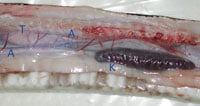 Anatomy 6 200
