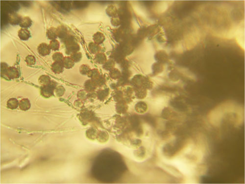 Chrysosporium spores