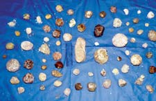 Tortoise Bladder Stones: 100 Cases In Review
